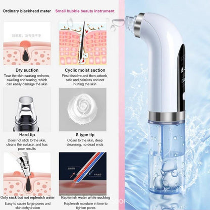 Electric Bubble Vacuum Blackhead Remover - Freedom!!