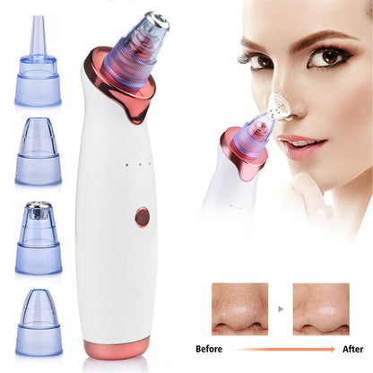 Electric Vacuum Facial Blackhead Remover - Freedom!!
