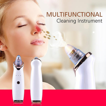 Electric Vacuum Facial Blackhead Remover - Freedom!!